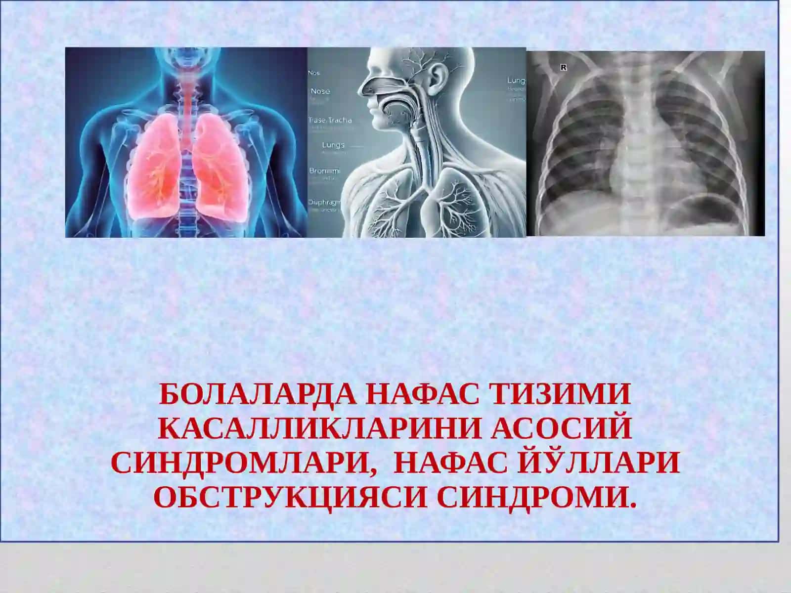bolalarda nafas tizimi kasalliklarini asosiy sindromlari 2