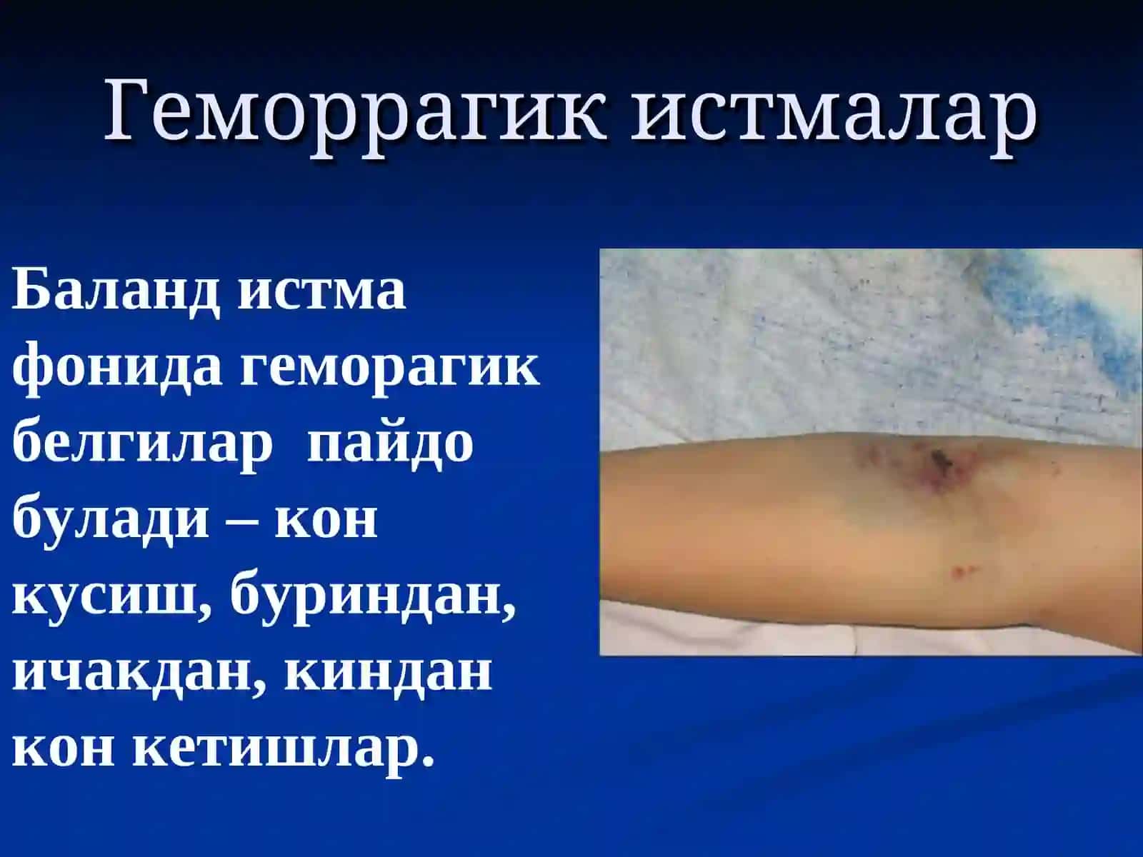 Геморрагик истмалар 2