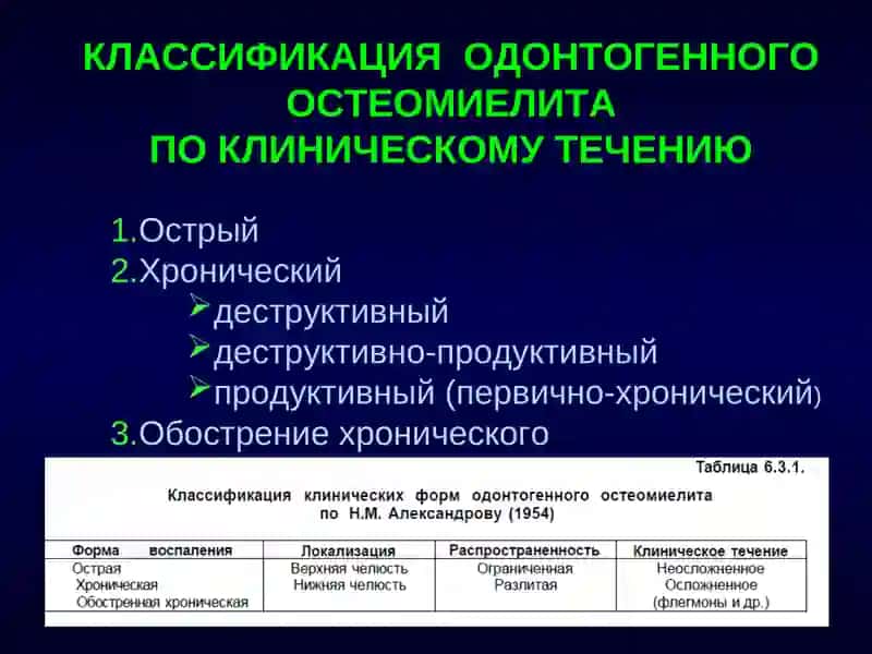 ОСТЕОМИЕЛИТ 2