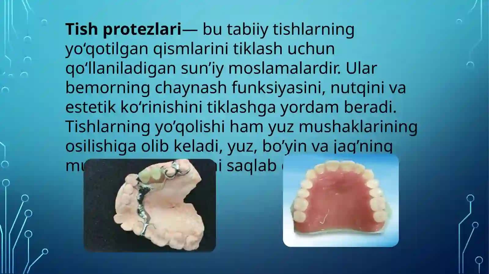 Tishprotezlarning tasnifi 2