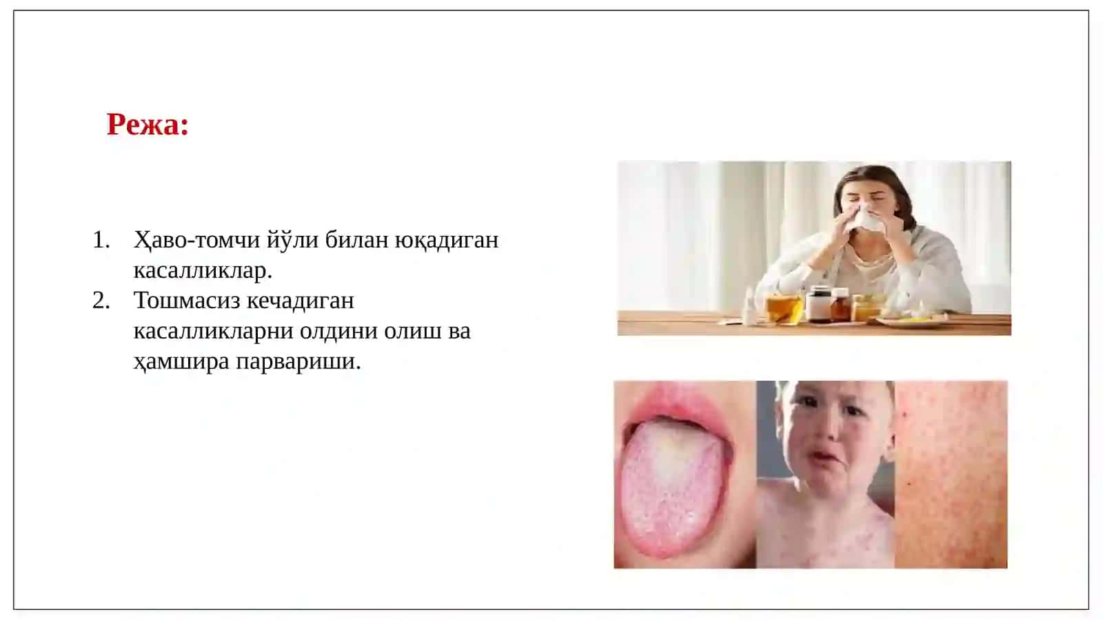 “Ҳаво-томчи йўли билан юқадиган касалликлар, тошмасиз кечадиган касалликларни олдини олиш ва ҳамшира парвариши” 2