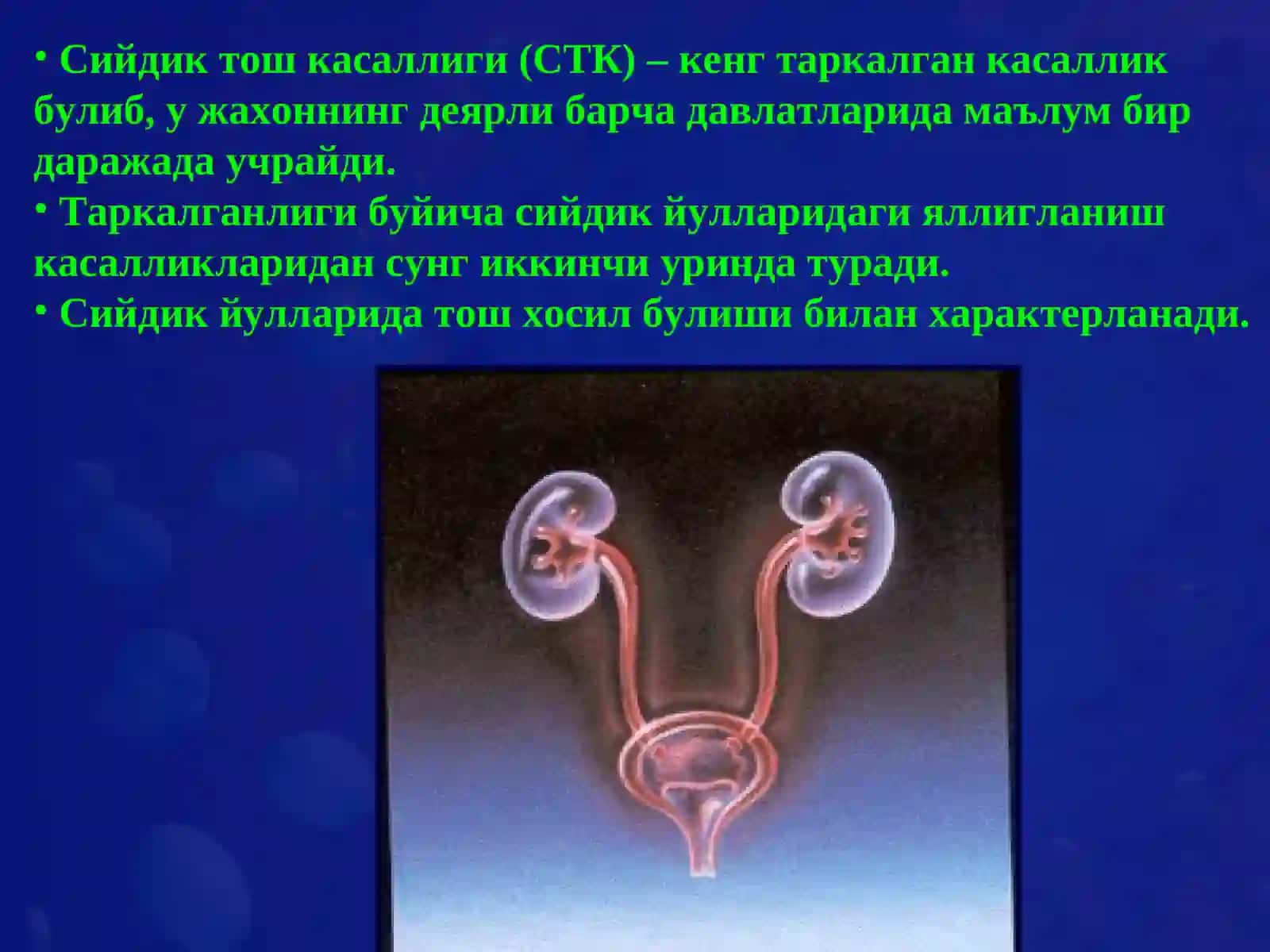 Сийдик тош касаллиги (СТК) 2