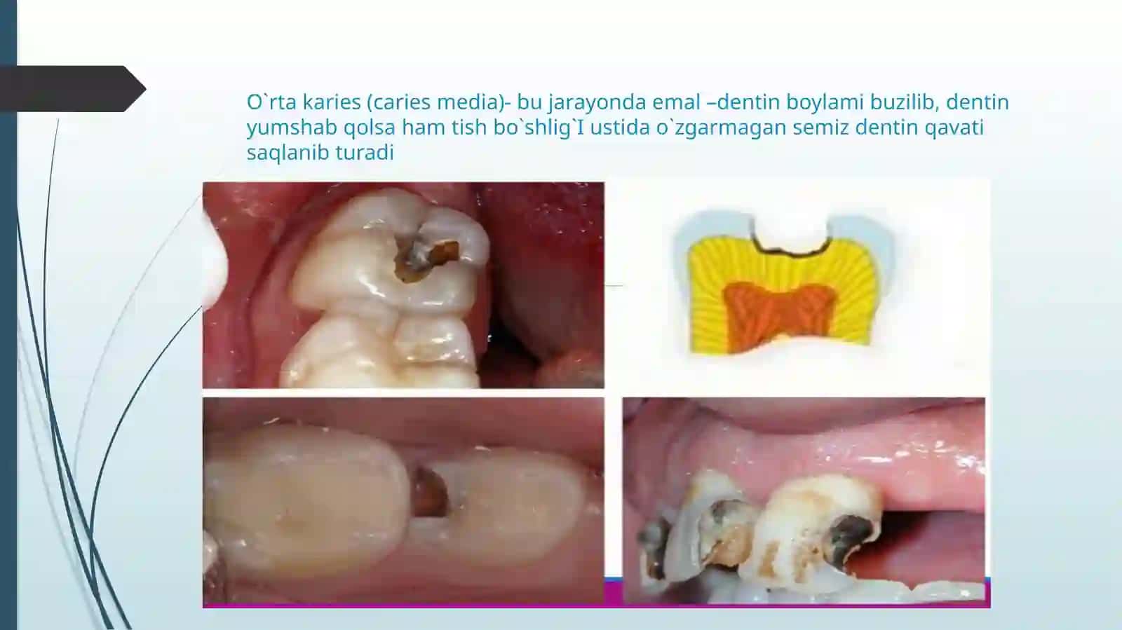 O`rtakaries O`tkir kechishi 2