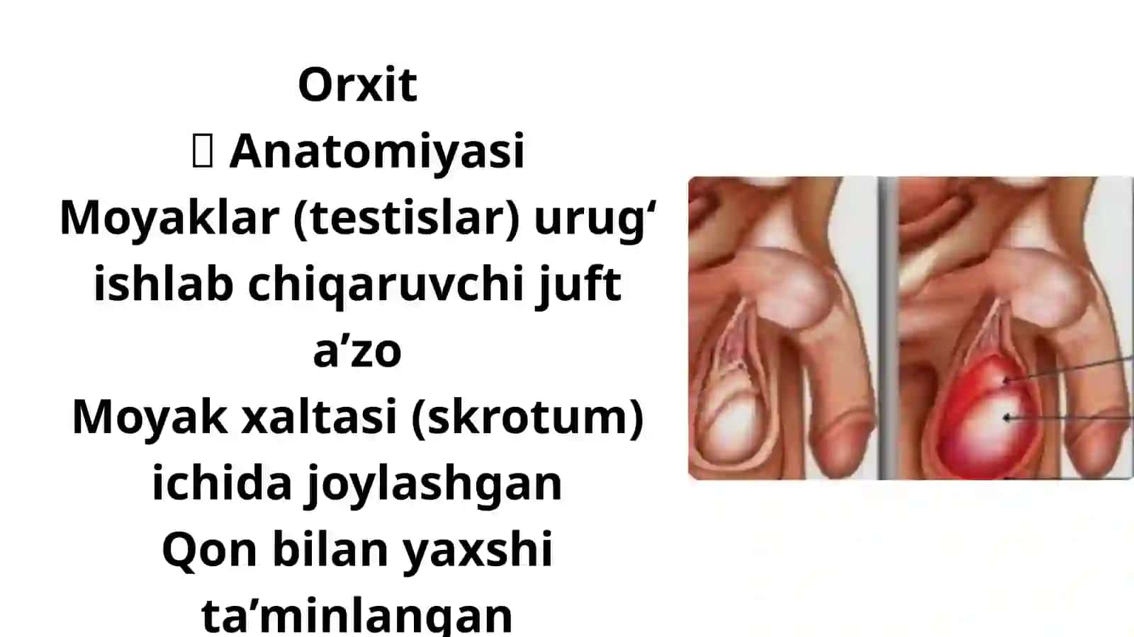 Orxit,prostatit,kriptoxizm 2