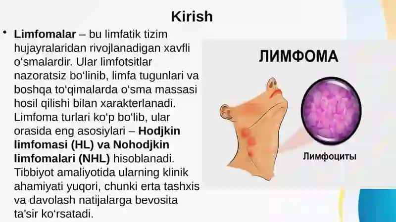 Hodjkin va Nohodjkin limfomasi . Ma'ruza uchun slayd 2