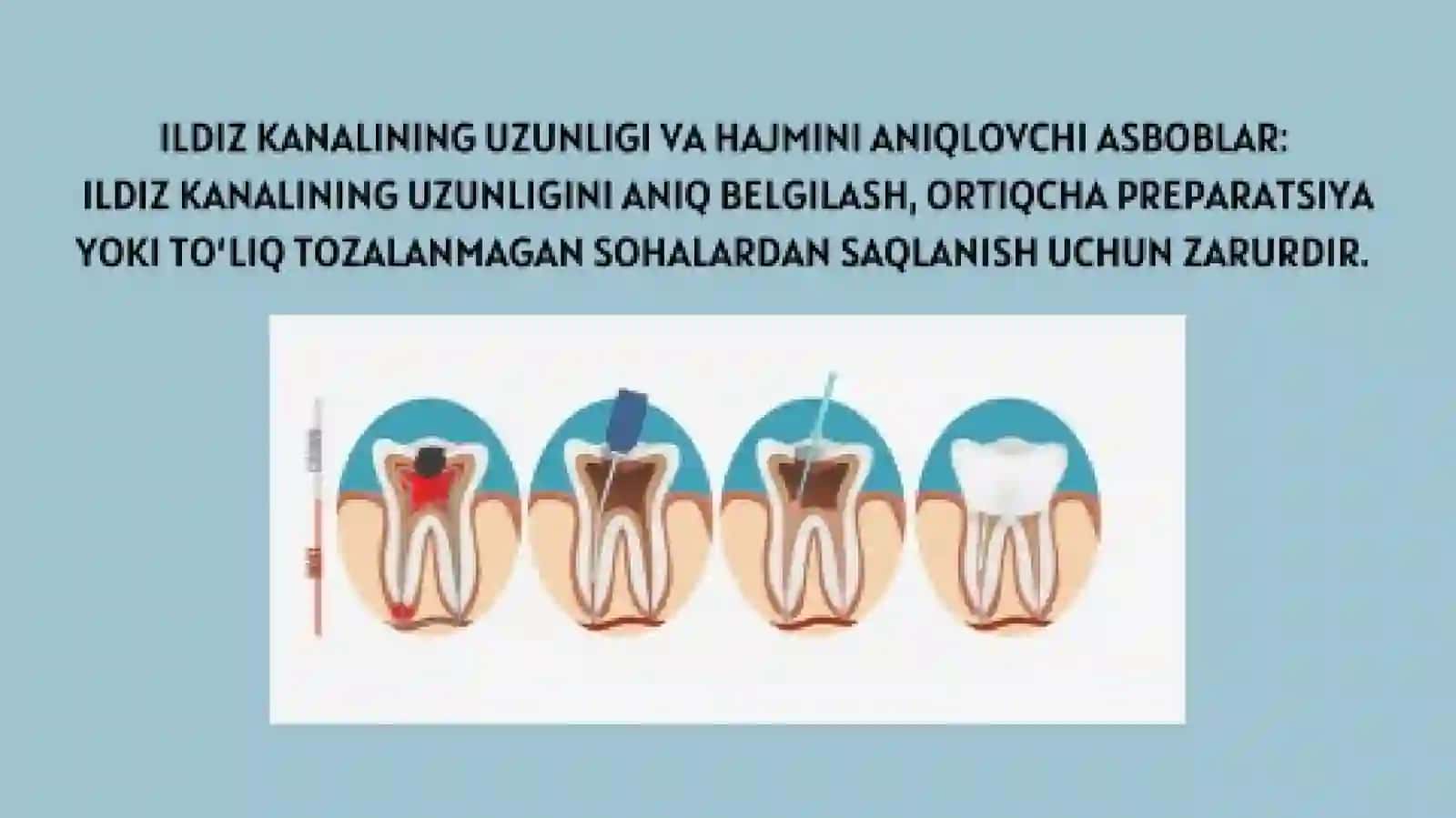 Ildiz kanal hajmini aniqlovchi vositalar 2