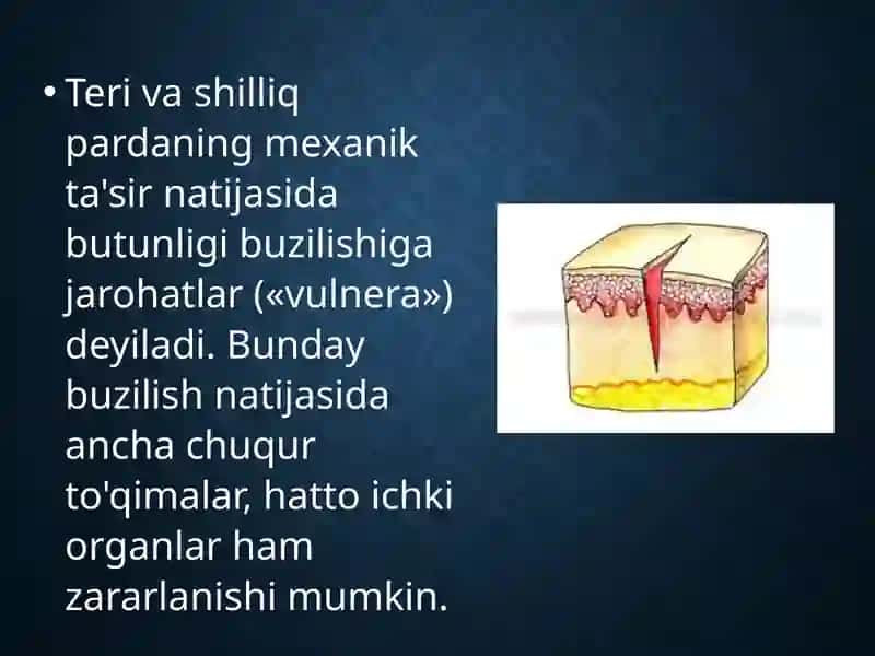 Jarohatlar tasnifi 2