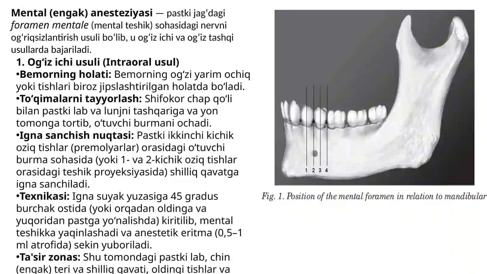 Mental og’riqsizlantirish-ningog’izichiva tashqiusuli 2
