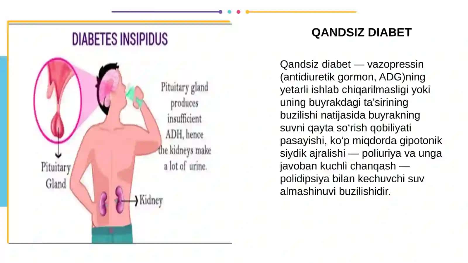 Qandsiz Diabet 2