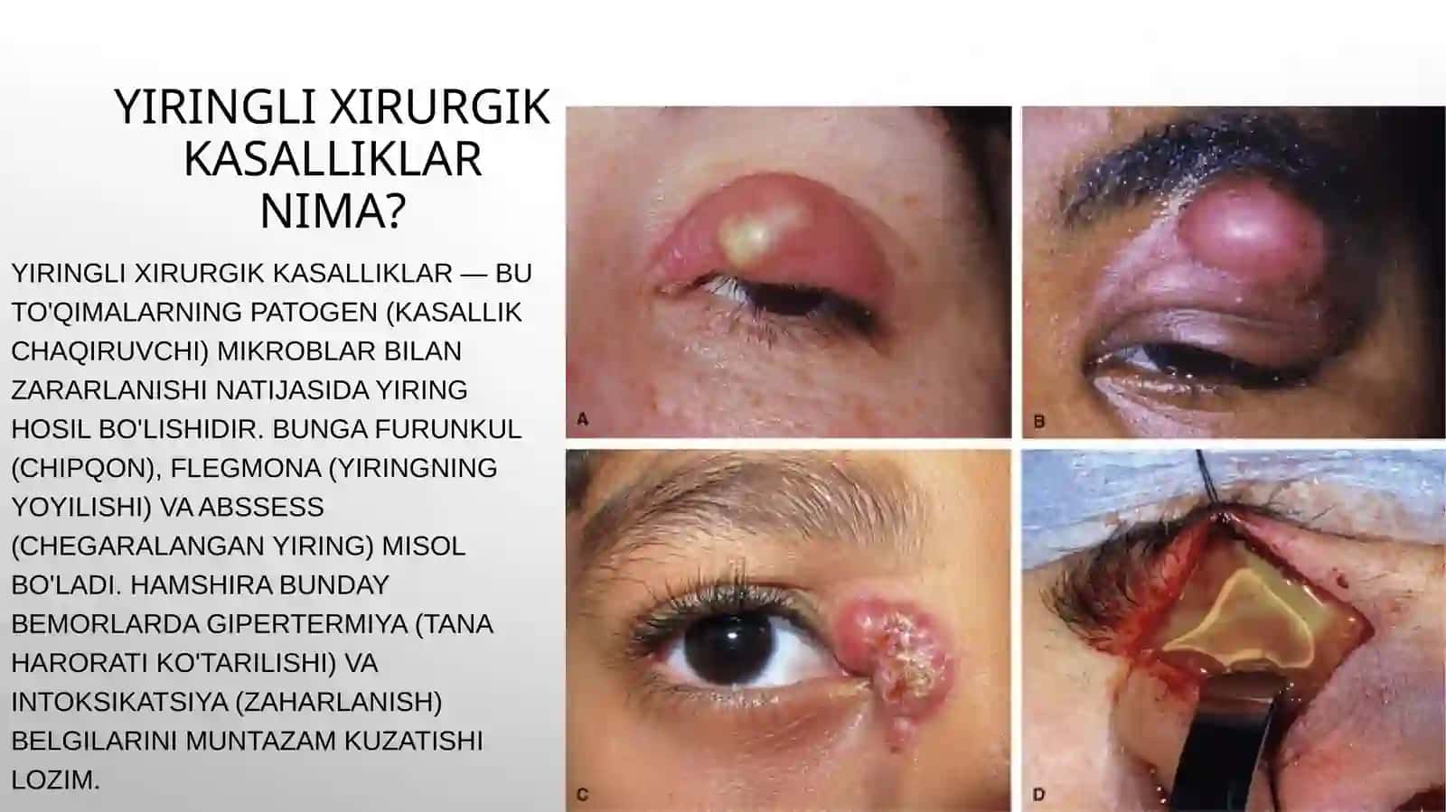 Tibbiyot kasbiga kirish/yiringli xirurgik kasalliklar bilan og'rigan bemorlarni parvarishi va xususiyatlari 2