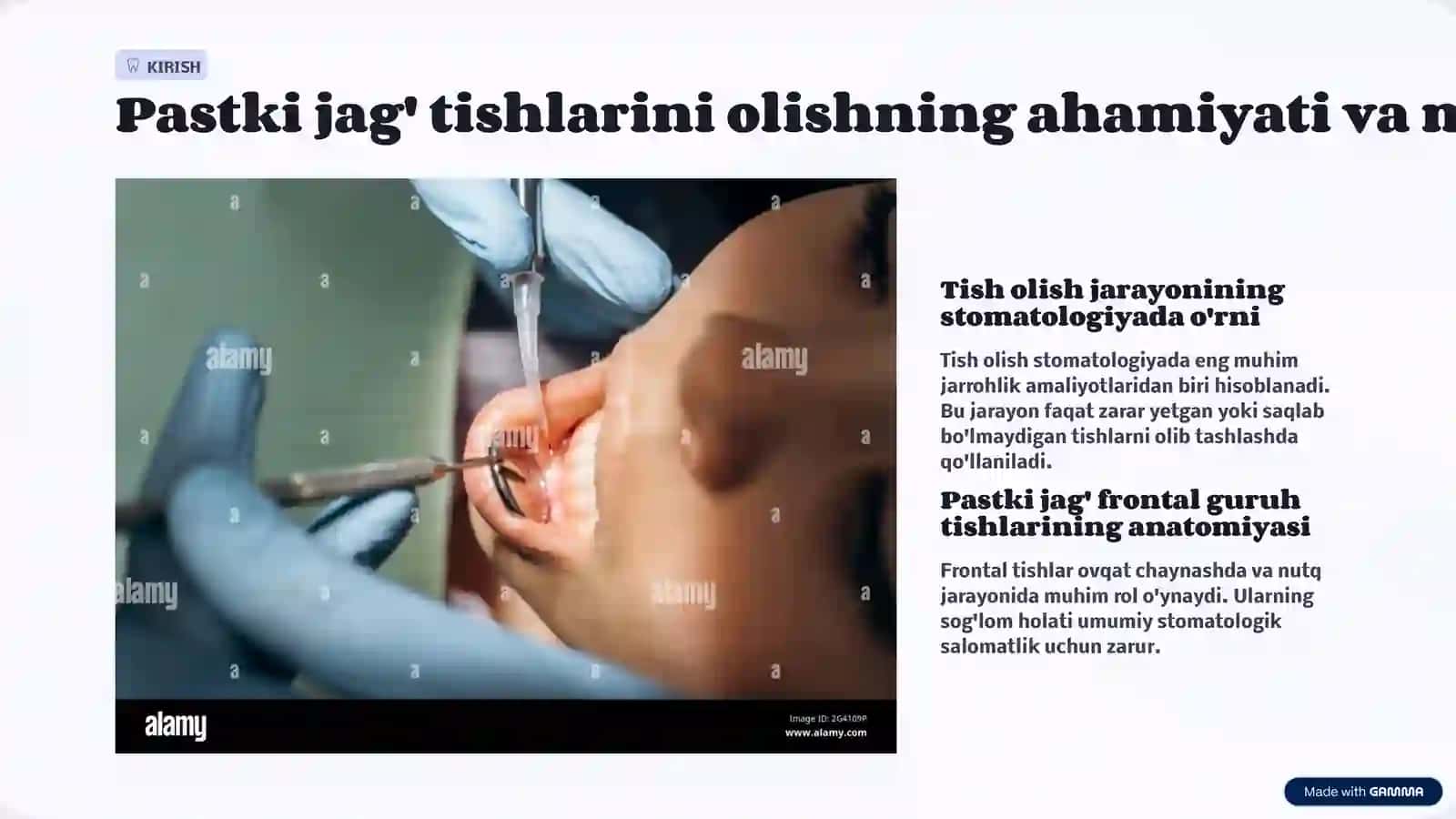 Bemоrdа pаstki jаg’ frоntаl guruh tishlаrini оlish texnikаsi. Omburlarni qo’llashno o’rganish Bemоrdа pаstki jаg’ kichik оziq tishlаrini оlish texnikаsi. Omburlarni qo’llashno o’rganish Bemоrdа pаstki jаg’ kаttа оziq tishlаrini оlish texnikаsi. Omburlarni qo’llashno o’rganish.. 2