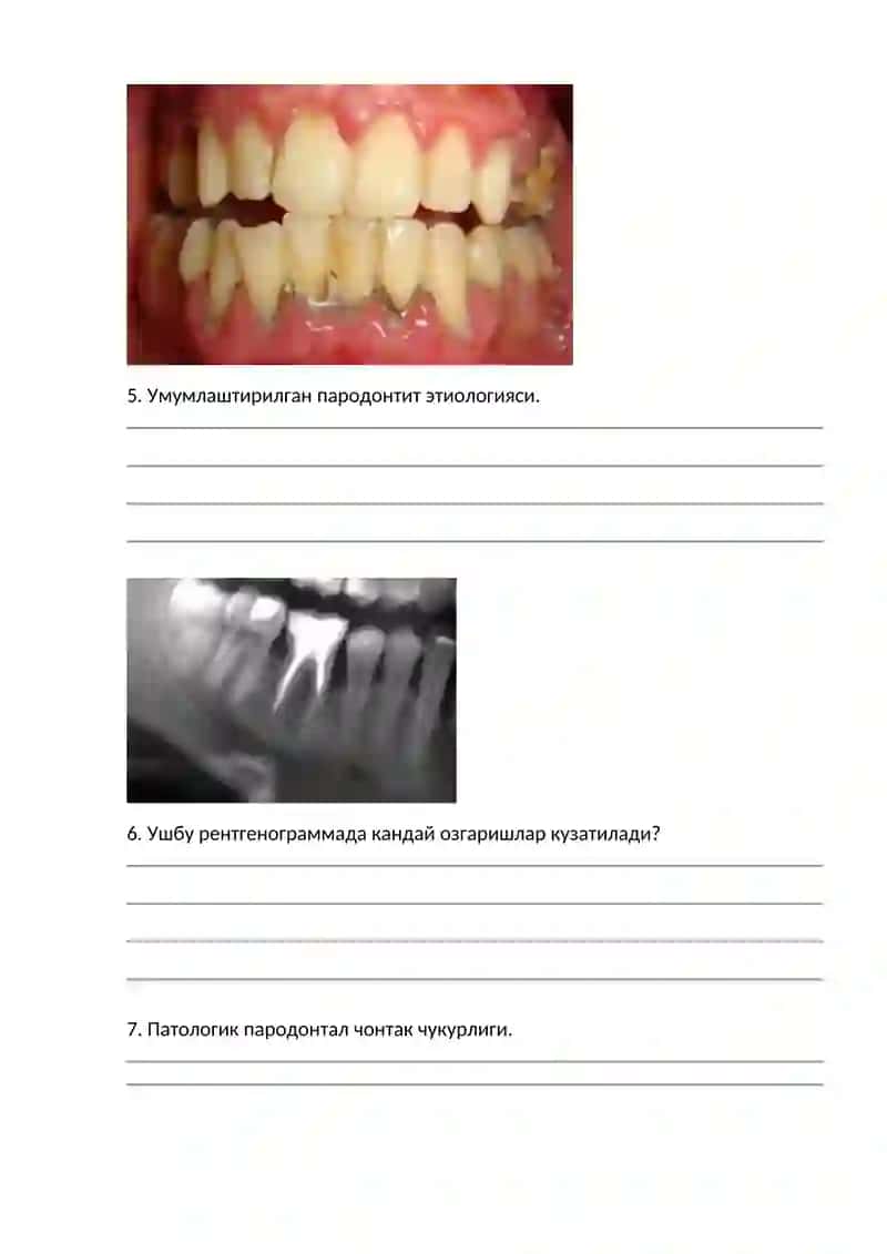 Bolalar parodontitning o‘ziga xos klinik kechishi. Klinikasi, tashxisi, rentgen tasviri 2