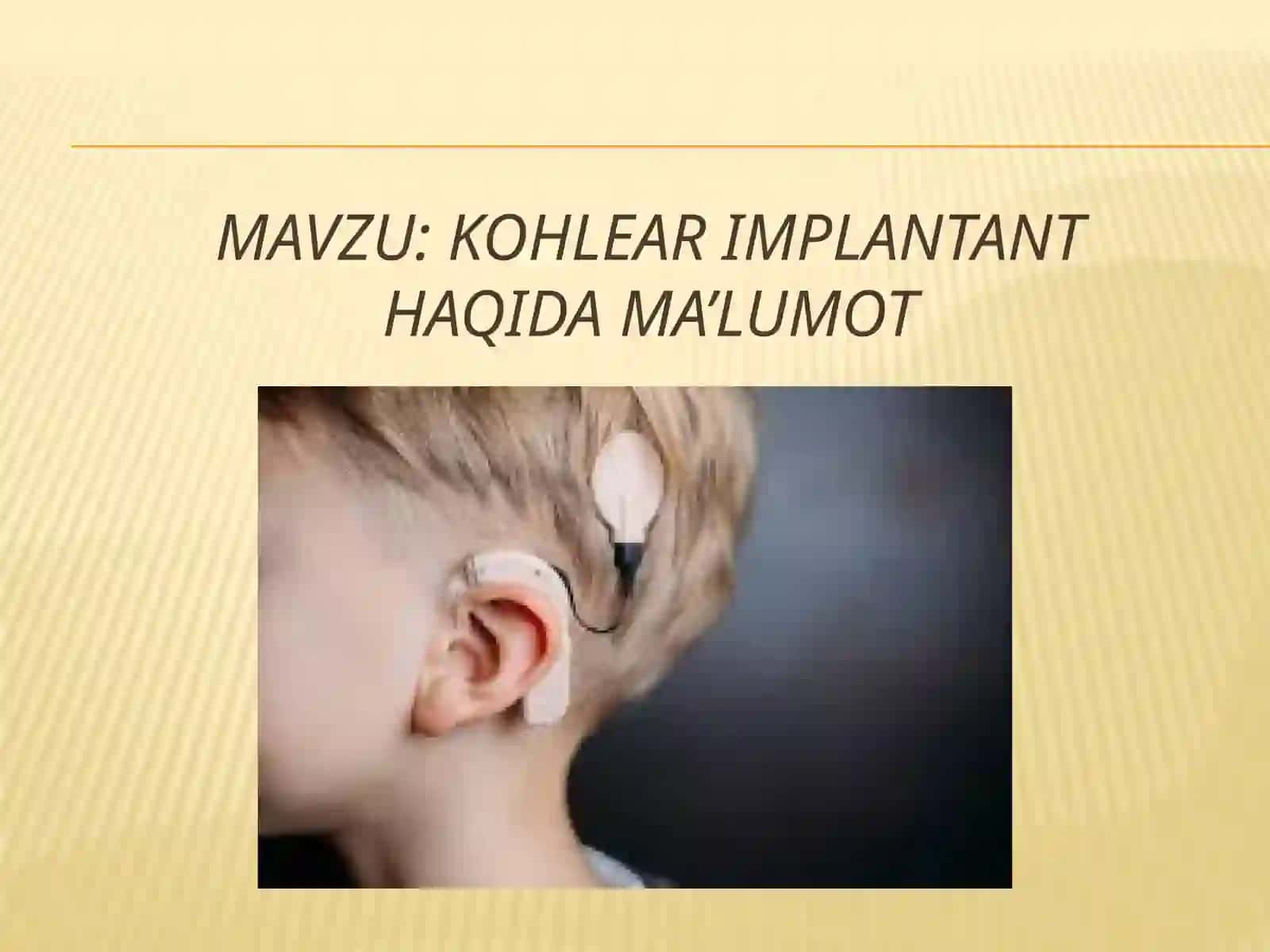 Kohlear implantant haqida ma’lumot 2