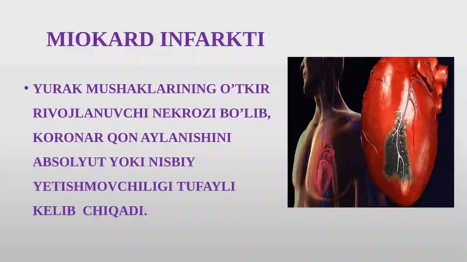 MIOKARD INFARKTI 2