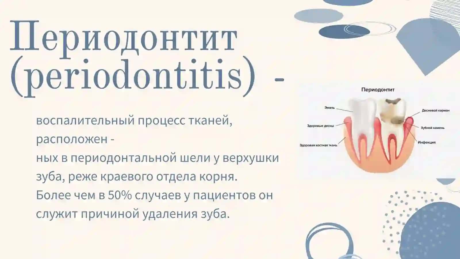 Периодонтиты острый и хронический 2