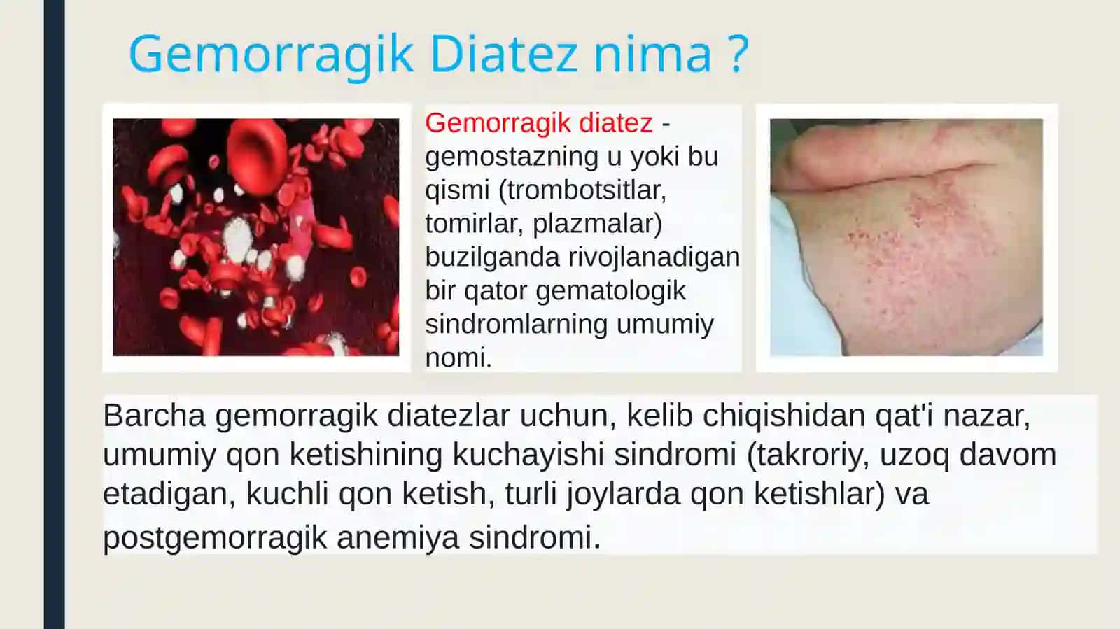 Gemorragik Diatezlar 2