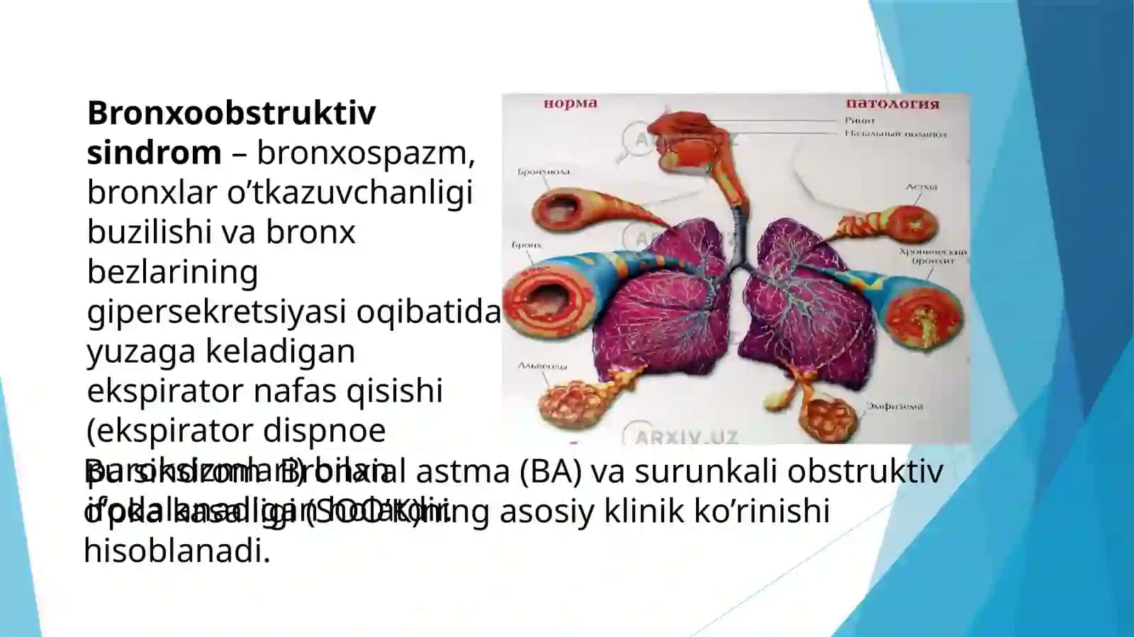 Bronxoobstruktiv sindromi davolashda qo`llaniladigan dori vositalarini ratsional qo`llashga klinik-farmakologik yondashuv 2