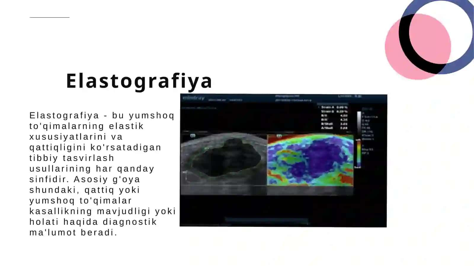 Elastografiya tekshirish usuli 2