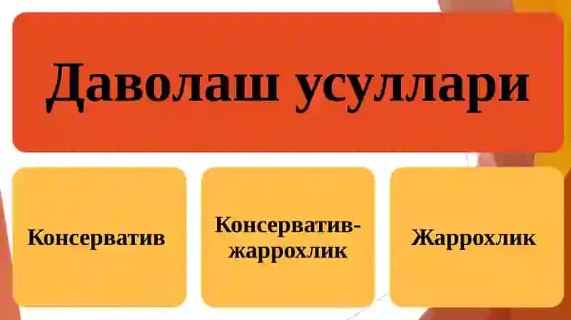 Периодонтитларни консерватив жаррохлик даволаш усули. Периодонтитларни даволашда стоматолог тактикаси. 2