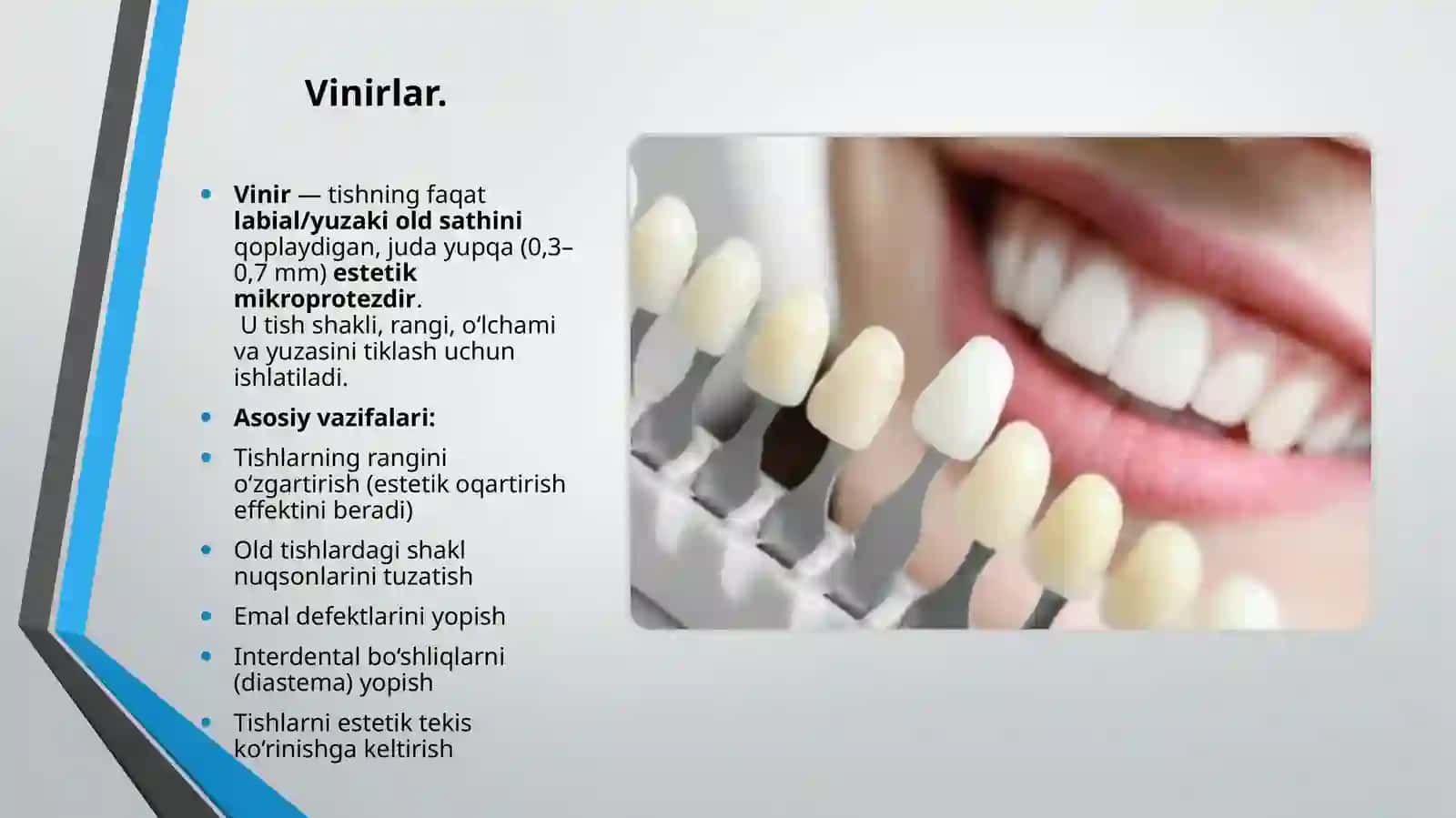 Vinirlar 2