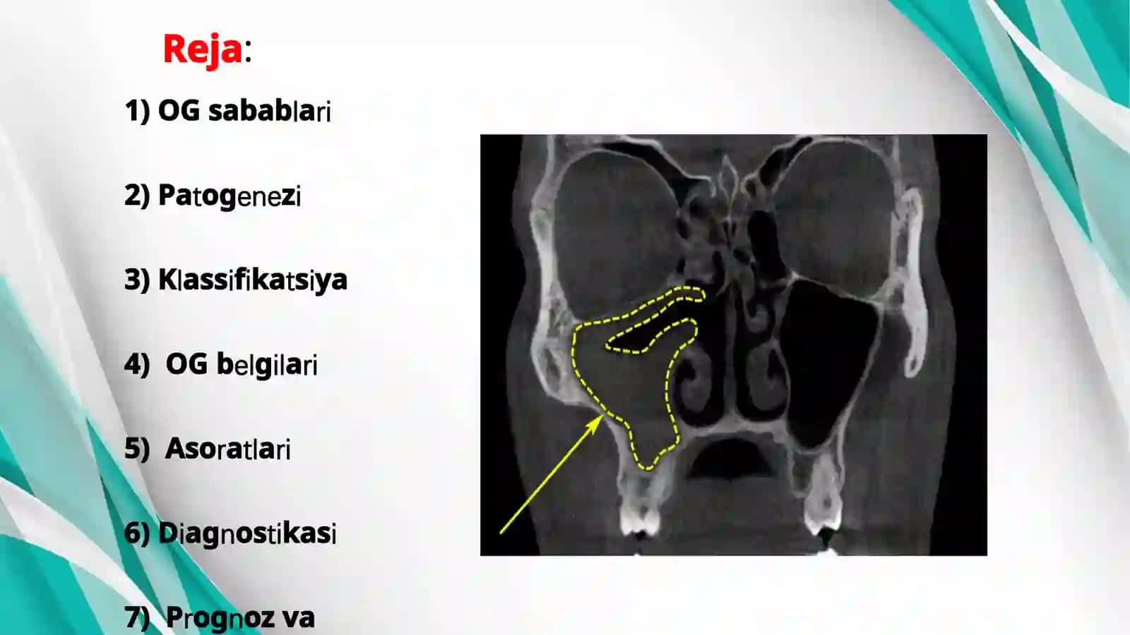 Odontogengaymorit 2