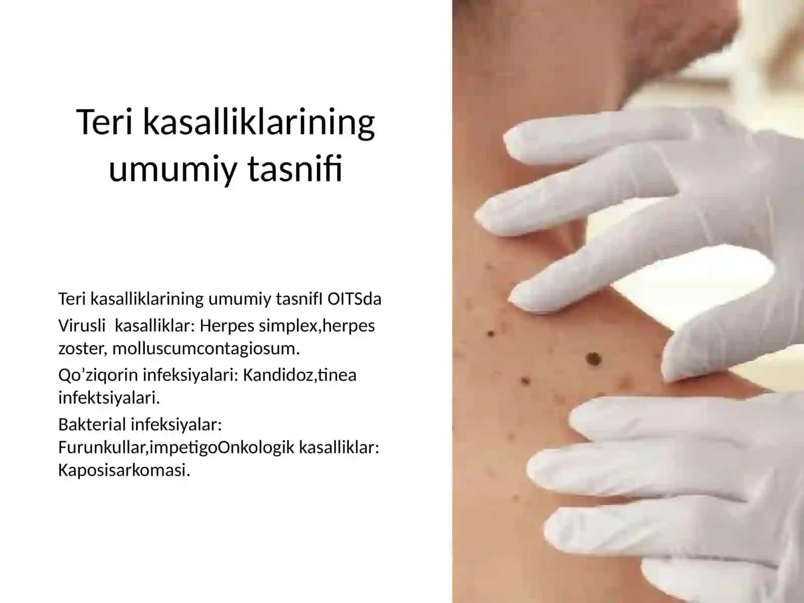 OITS va immunitet 2