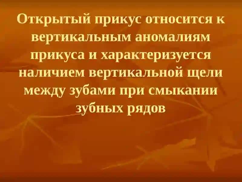 ОТКРЫТЫЙ ПРИКУС 2