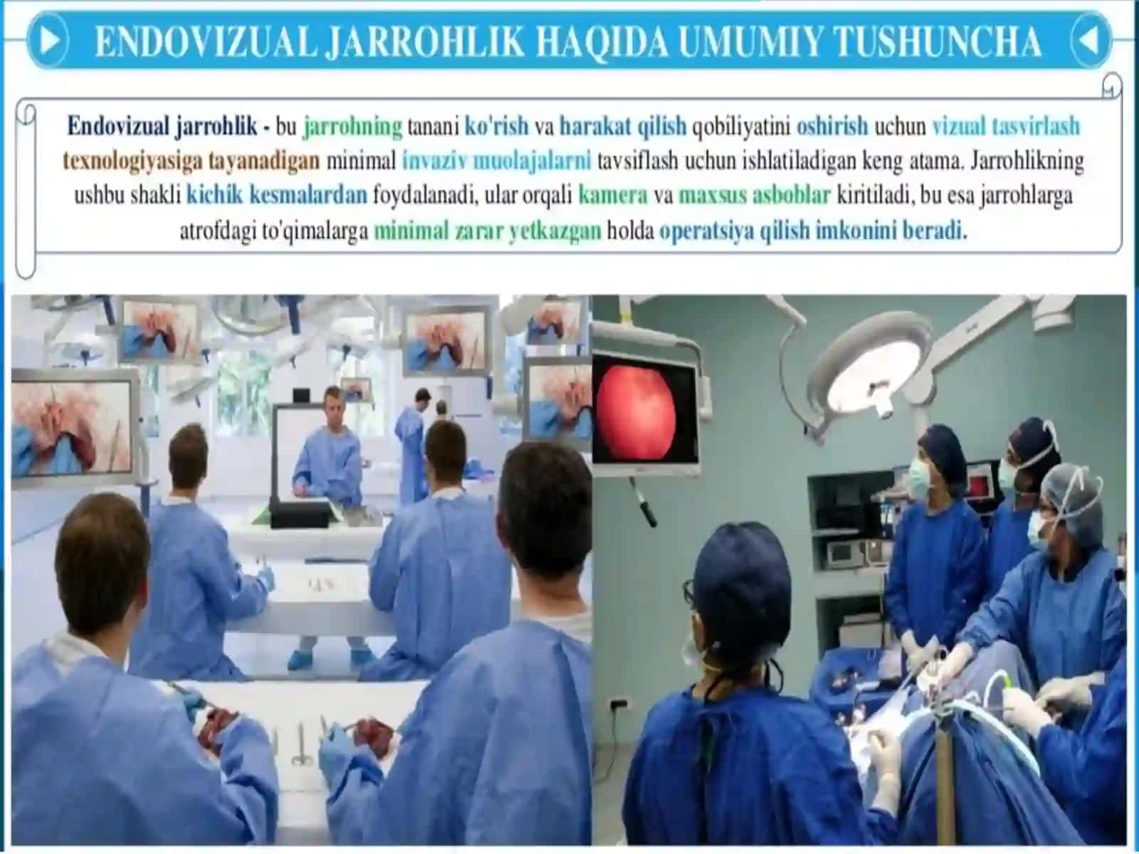 Endovizual,robototexnika va gibrid operatsiyalar haqida tushuncha 2