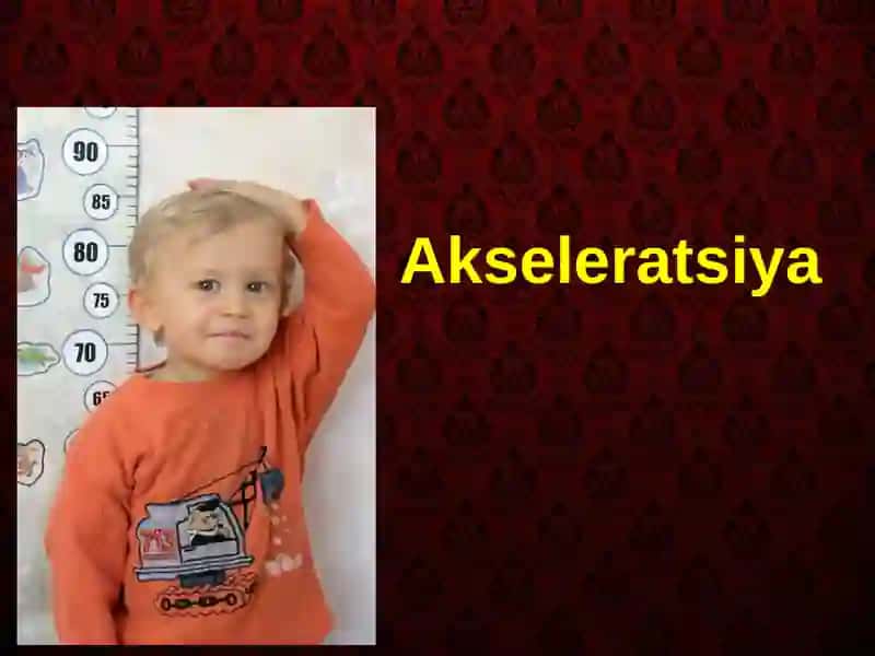 Akseleratsiya 2