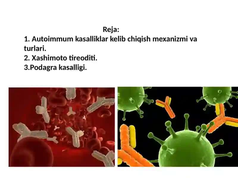 Autoimmun kasalliklar 2