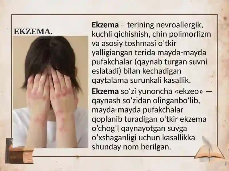 Ekzema 2