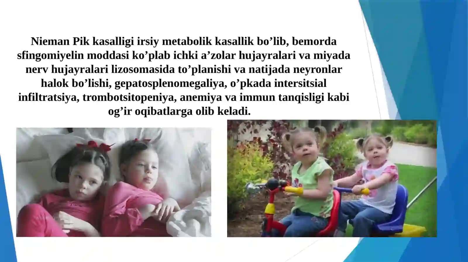 Nieman Pik kasalligi 2