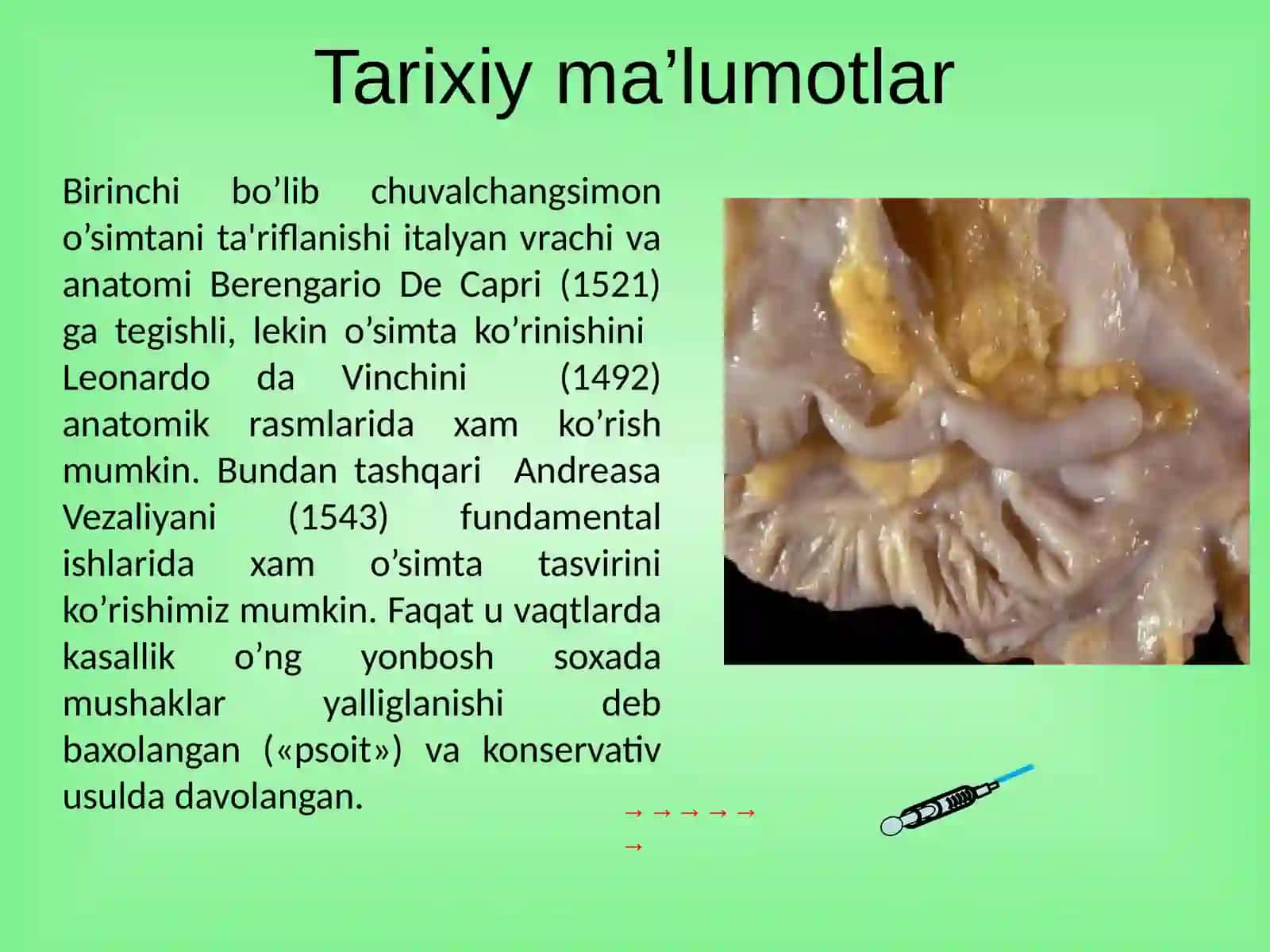 O’tkir appenditsit 2