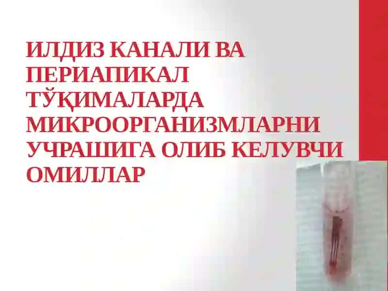 Илдиз канал тизимининг микробиологик таркиби 2