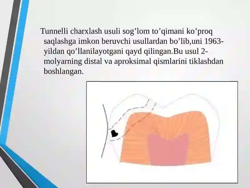 Tunnelli charxlash 2