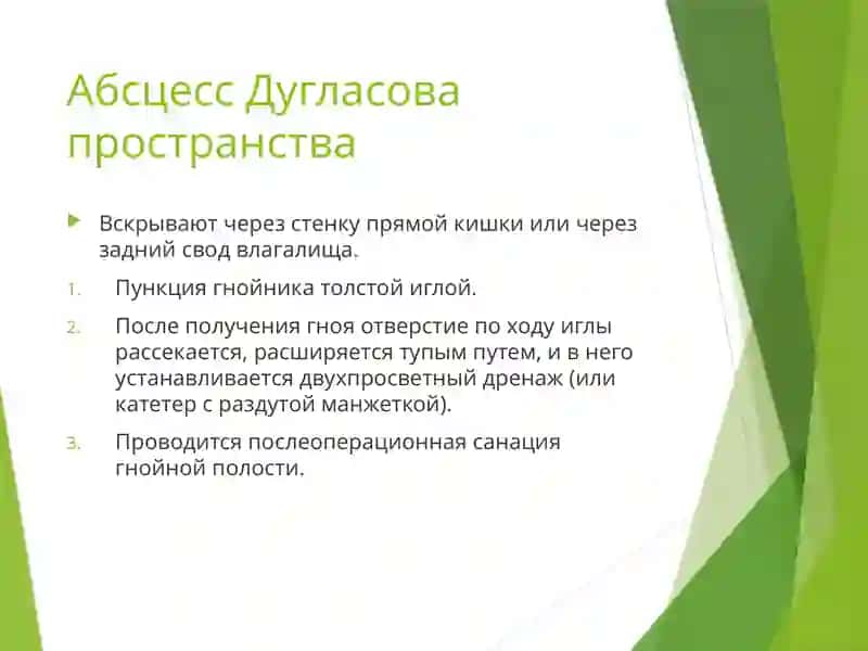 Дугласс Бушлиғи 2