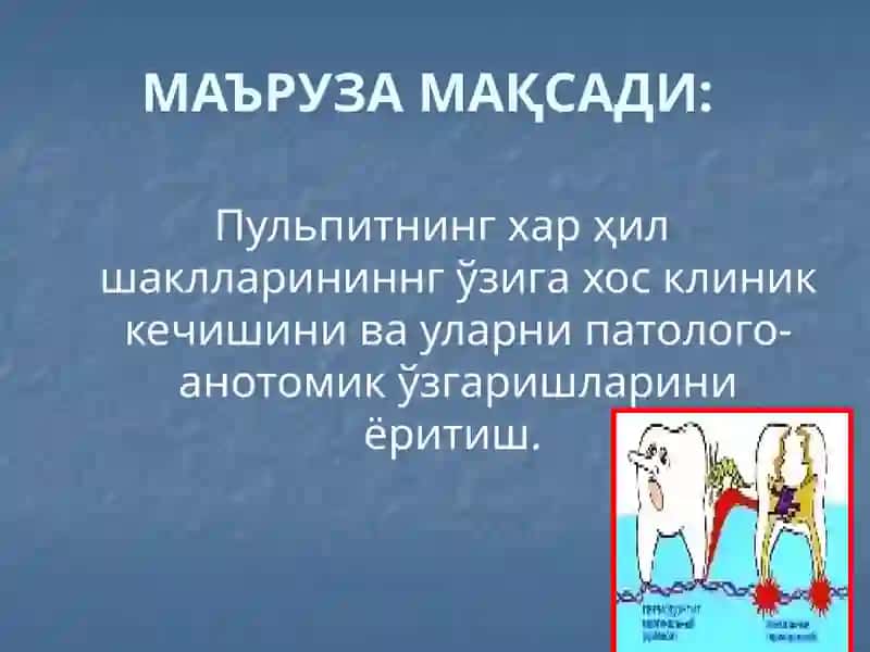 Пульпитларни клиникаси, патологик анатомияси, диагностикаси ва киёсий ташхиси 2