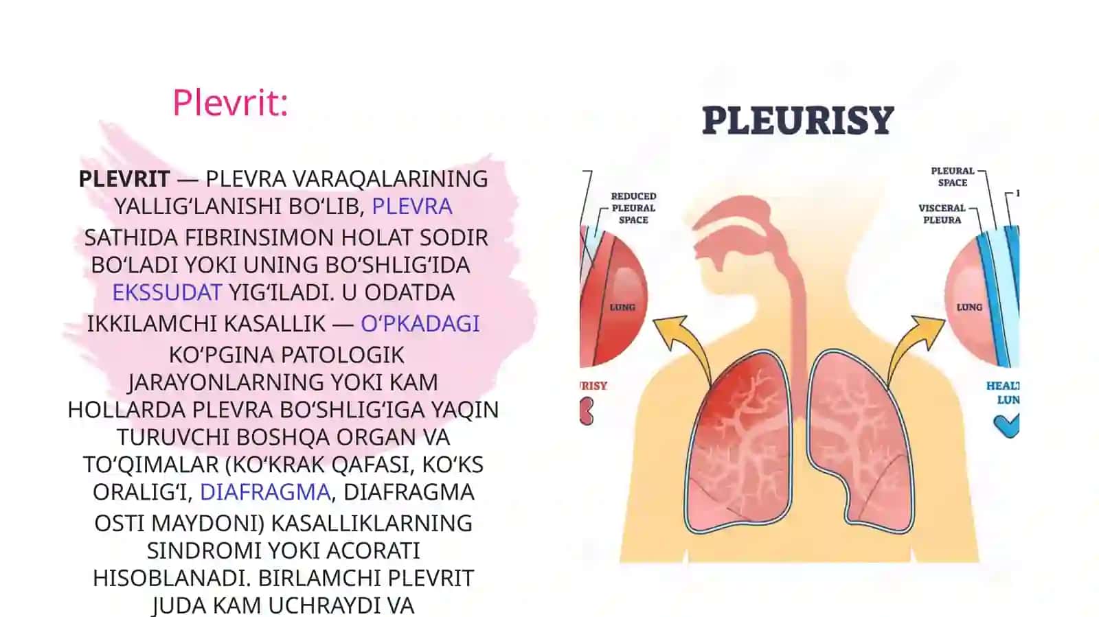 Plevrit 2