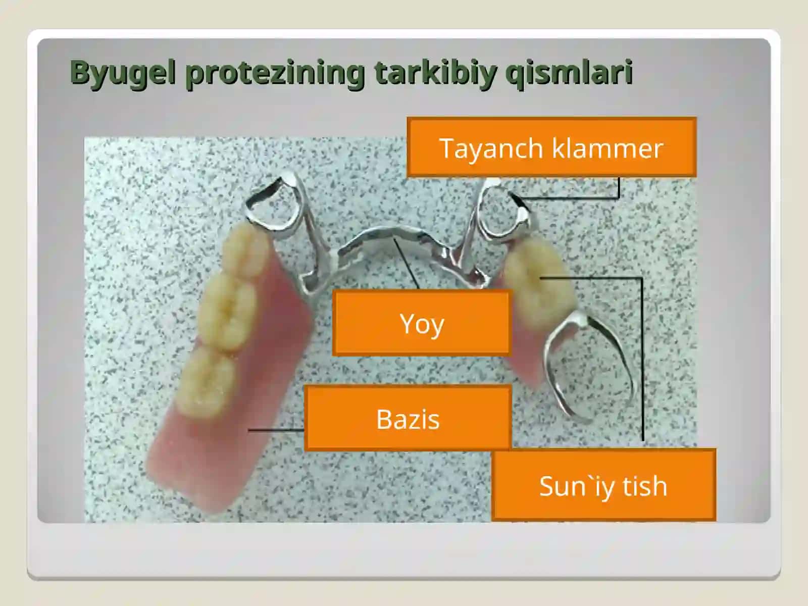 Byugel protezlar bilan protezlashda yuzaga keladigan asoratlar 2