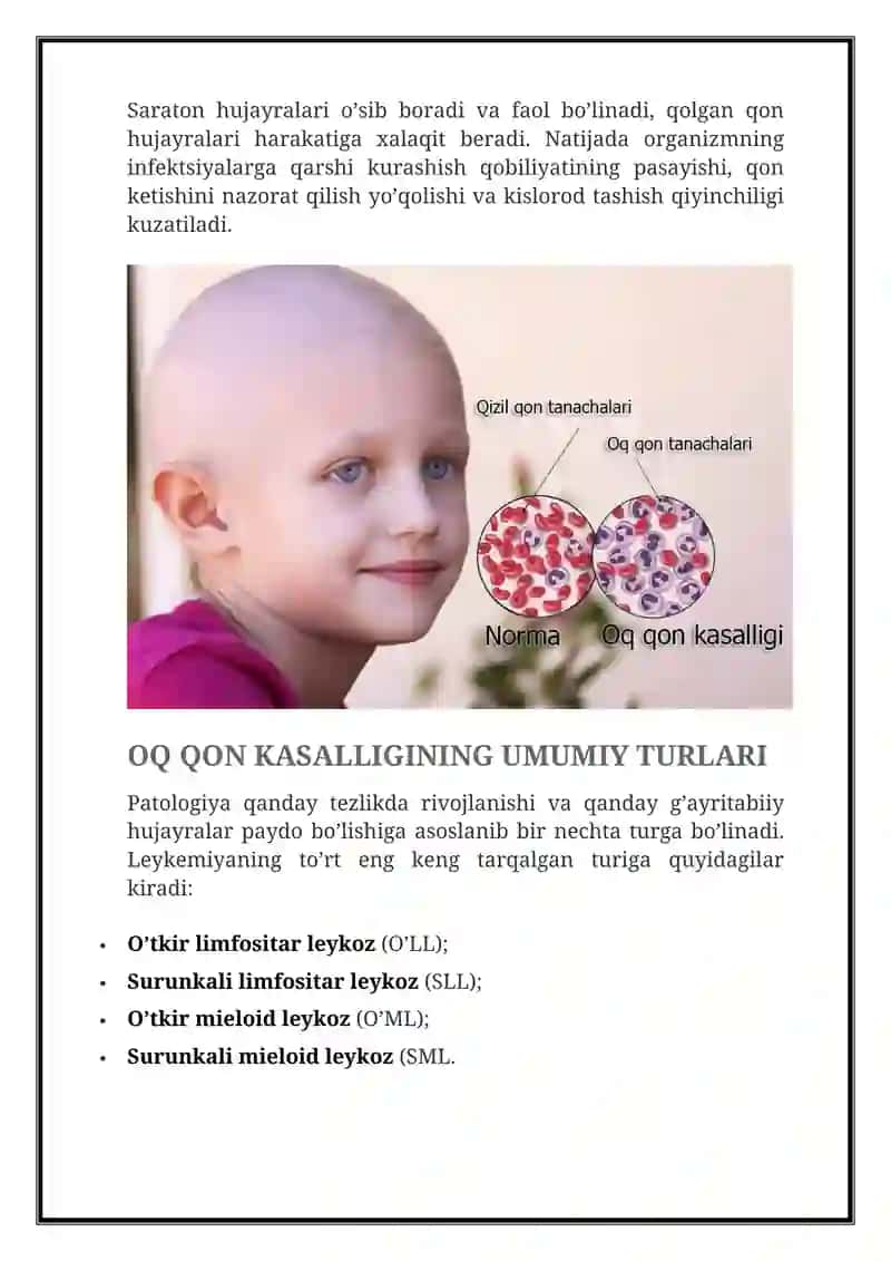LEYKOZ VA TURLARI 2
