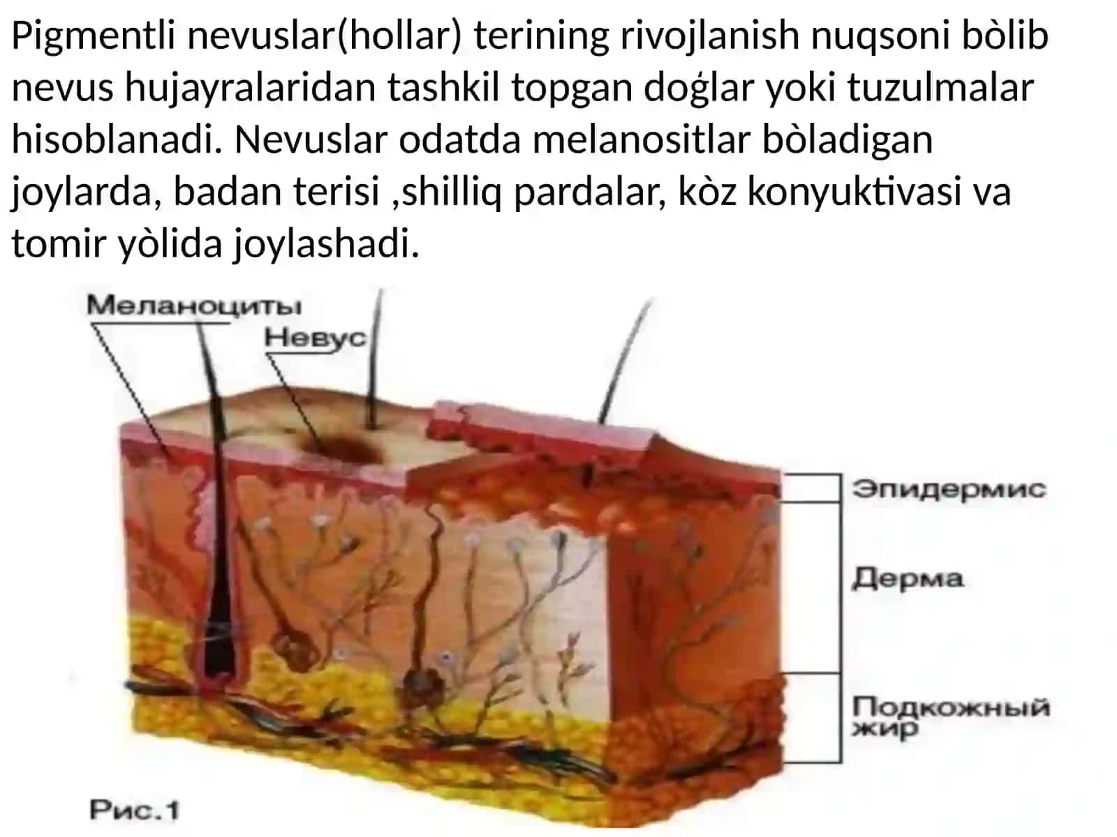 NEVUSLAR 2