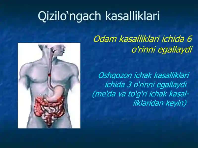 Qizilo‘ngach kasalliklari 2