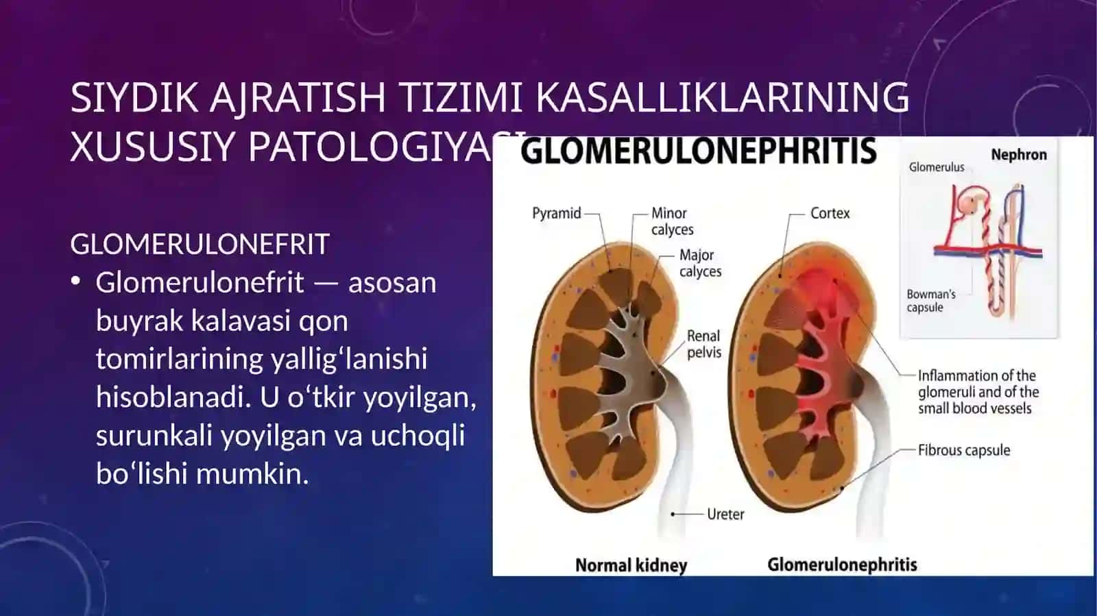 Buyrak va siydik yo‘llari kasalliklaridagi bemorlarda asosiy kliniksindromlar. O‘tkir, Surunkali Glomerulonefrit, Piyelonefrit simptomotologiyasi. Buyrak kasalliklaridagi bemorlarni laboratoriya va funksional tekshirish usullari 2
