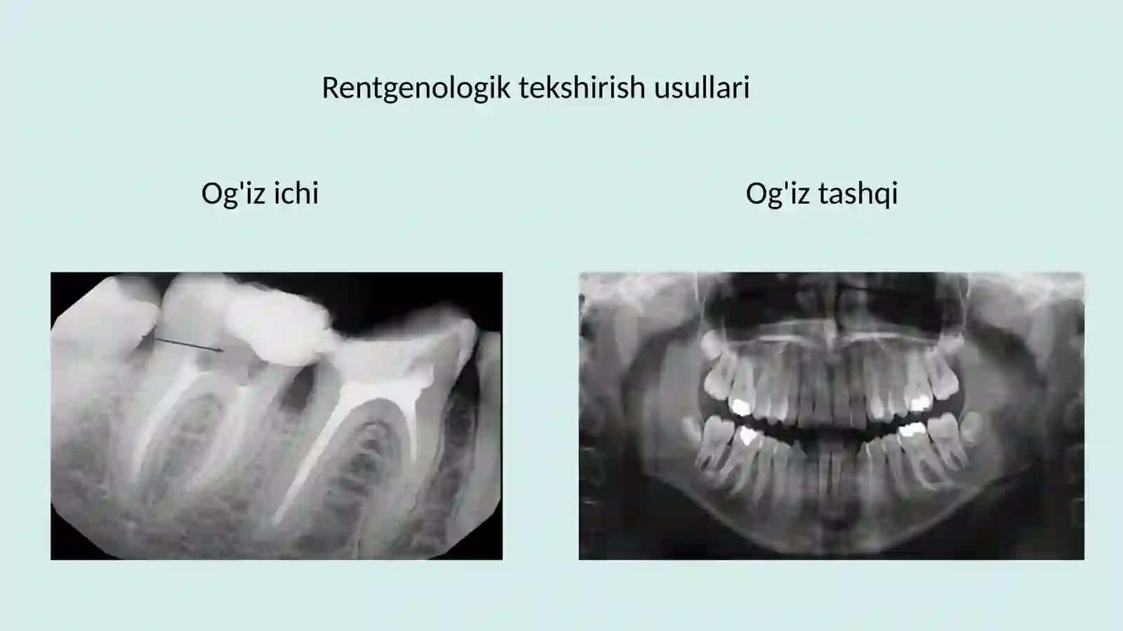 Stomatologiyada rentgen tekshiruvi 2