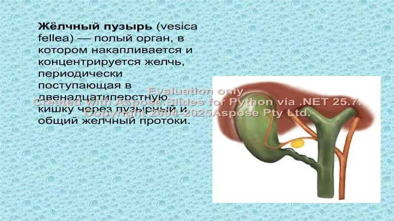 Острый холецистит 2