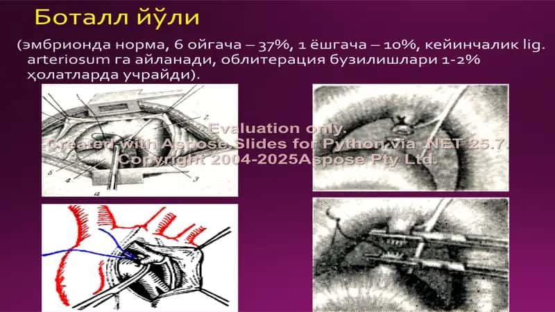 Laparotomiya turlari 2