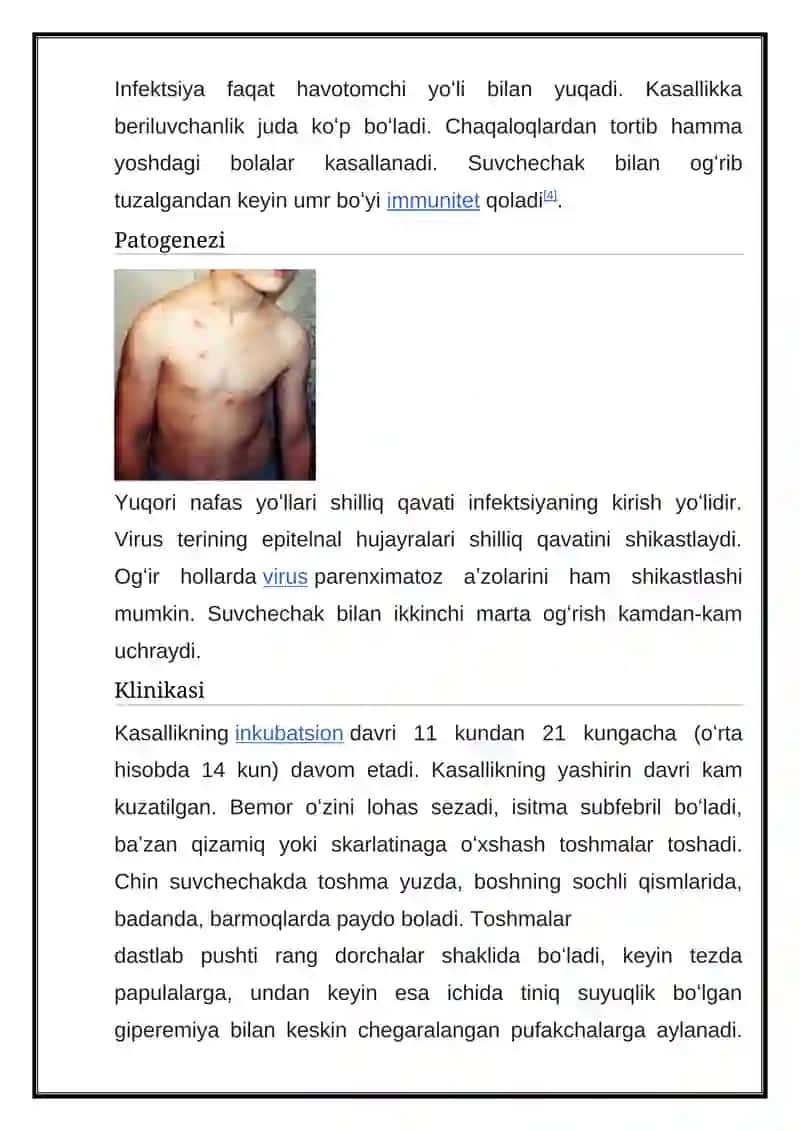 SUVCHECHAK 2