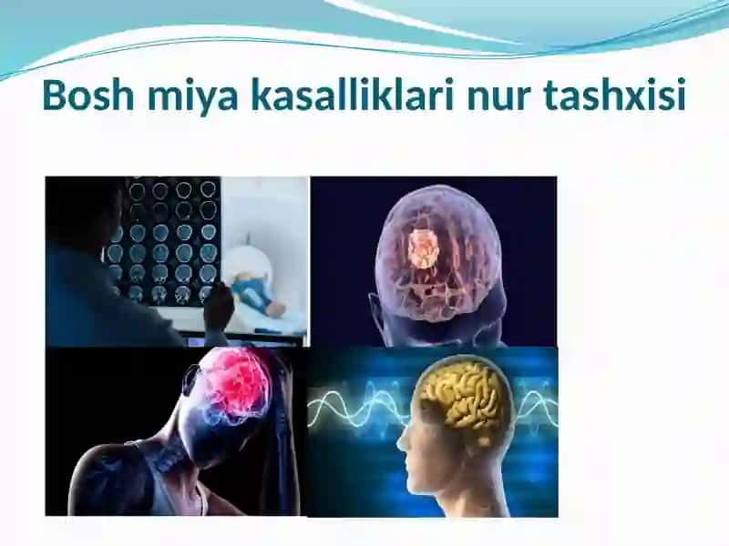 Radiologiya fanidan mustaqilishi 2