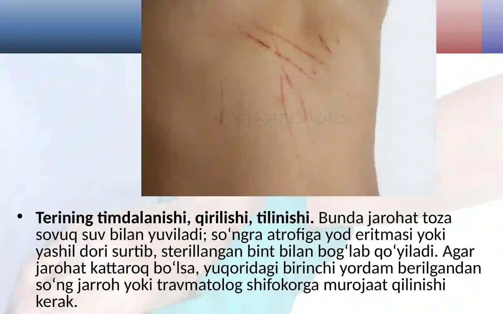 Teri  shikastlanganda  birinchi  yordam 2