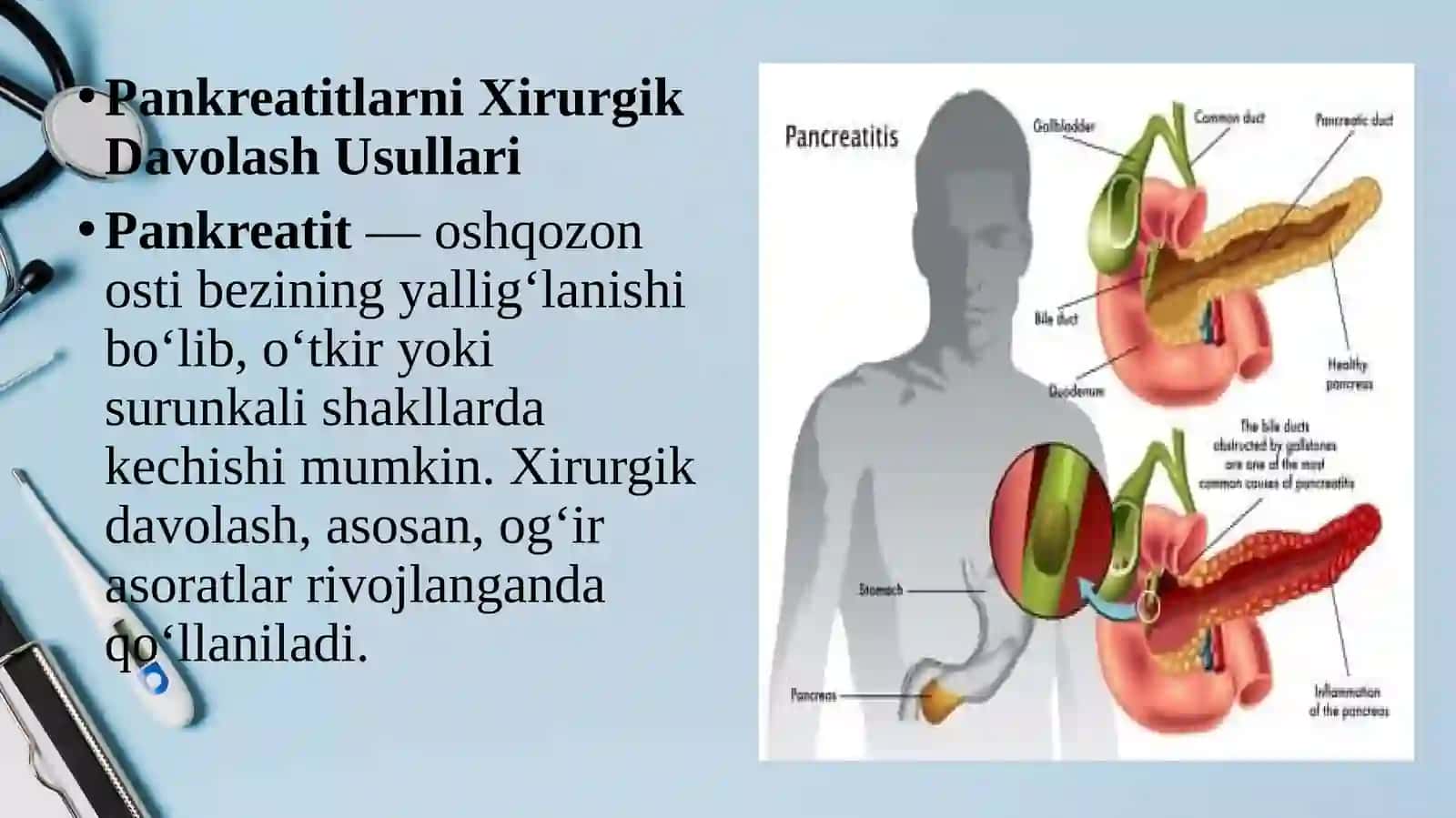 Pankreatitlarnixirurgik davolash usullari.Mekkel divertikulini olibtashlash 2